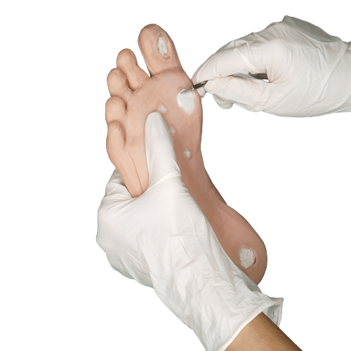 Corn and Callus debridement trainer - Medimodels