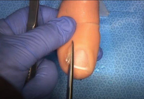 Patient safety and scalpel skills in podiatry - Medimodels